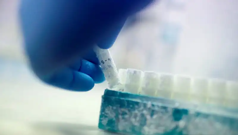 Tıbbi Felaket: 85 Sperm Donörü, Binlerce Çocuğa Baba Olmuş!
